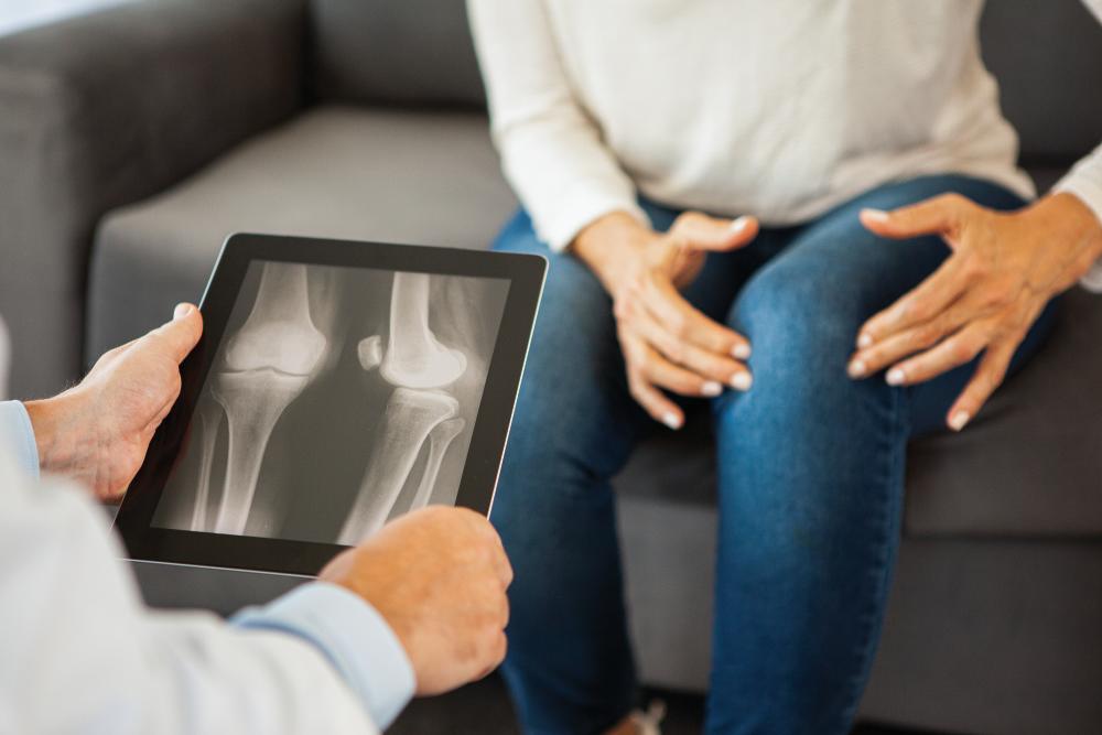 Patient showing knee pain to doctor examining X-ray report on digital tablet in living room during COVID - 19
